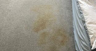 Stain Removal